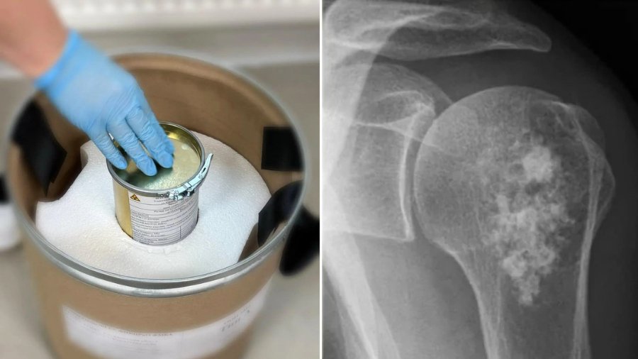 cortesia-radiofarmaco-223ra-54733